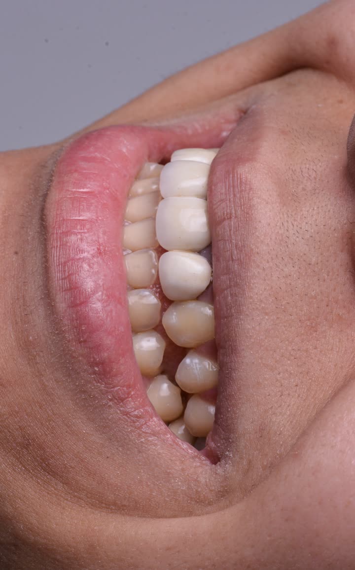 محتوى سناب شات لـ Dr Munther ✨🦷