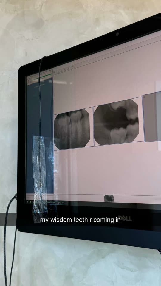 caitlineoneill