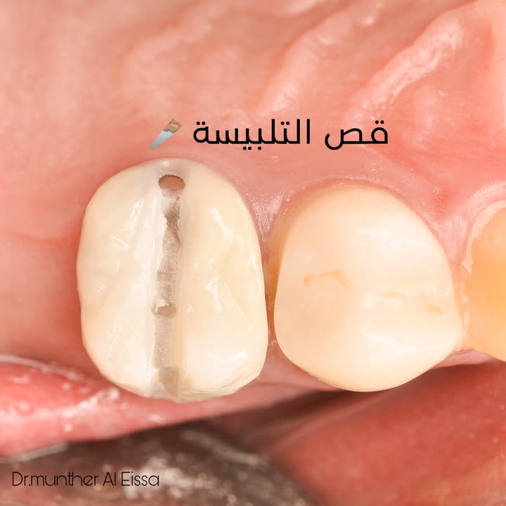 محتوى سناب شات لـ Dr Munther ✨🦷