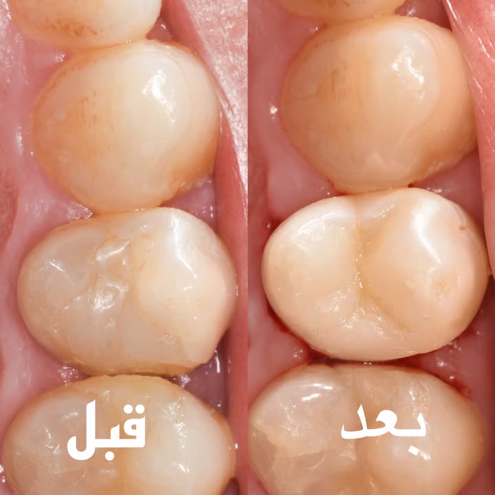 محتوى سناب شات لـ Dr Munther ✨🦷