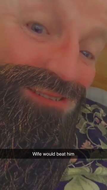 Preview for a Spotlight video that uses the Airy Beard Lens
