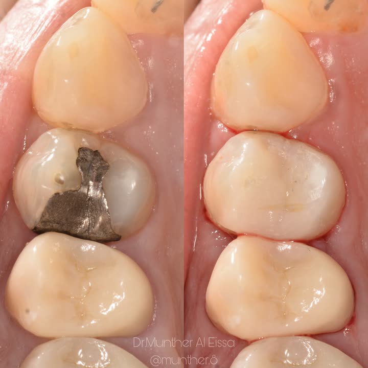 محتوى سناب شات لـ Dr Munther ✨🦷