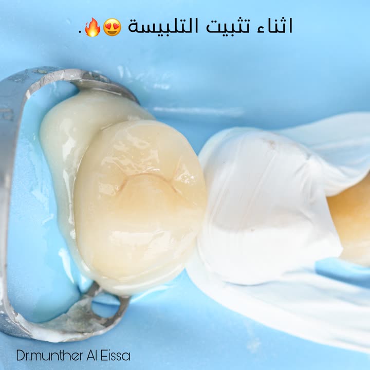 محتوى سناب شات لـ Dr Munther ✨🦷