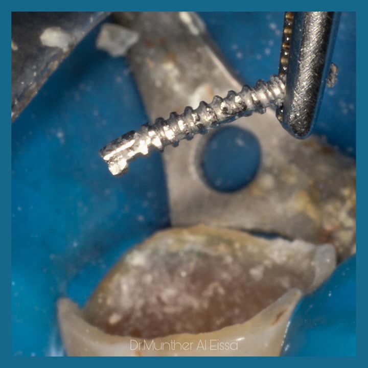 محتوى سناب شات لـ Dr Munther ✨🦷