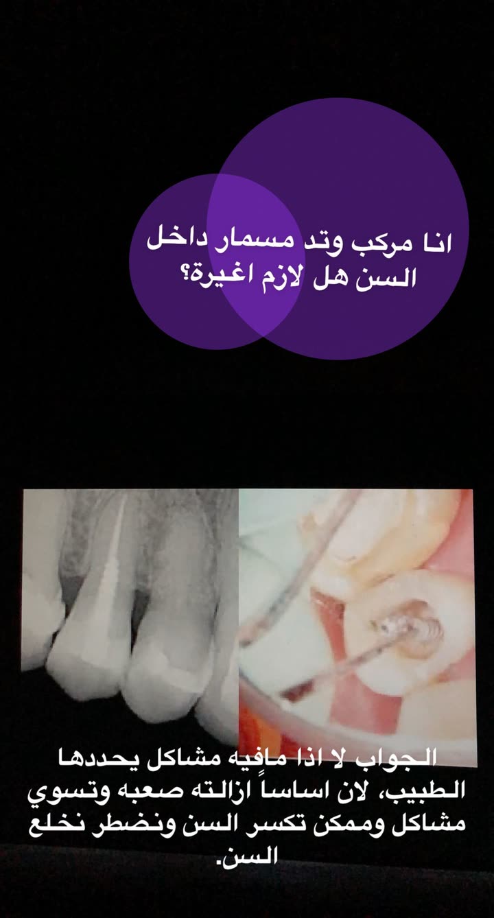 محتوى سناب شات لـ د. ساره الفدا