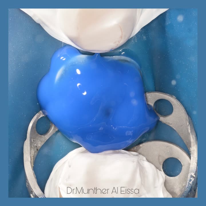 محتوى سناب شات لـ Dr Munther ✨🦷
