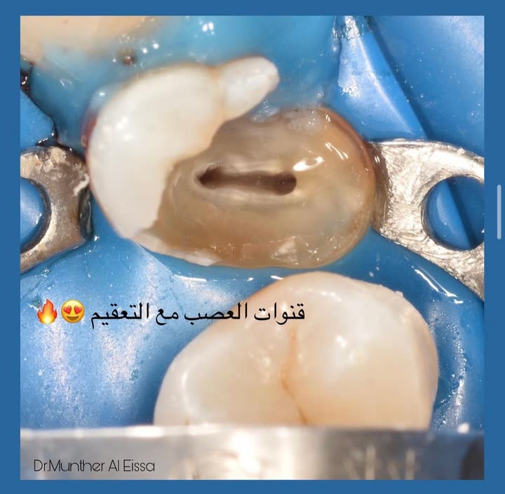 محتوى سناب شات لـ Dr Munther ✨🦷