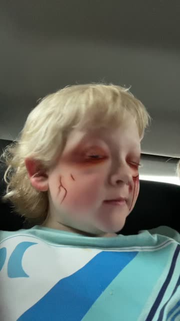 Preview for a Spotlight video that uses the FIGHT WOUND Lens