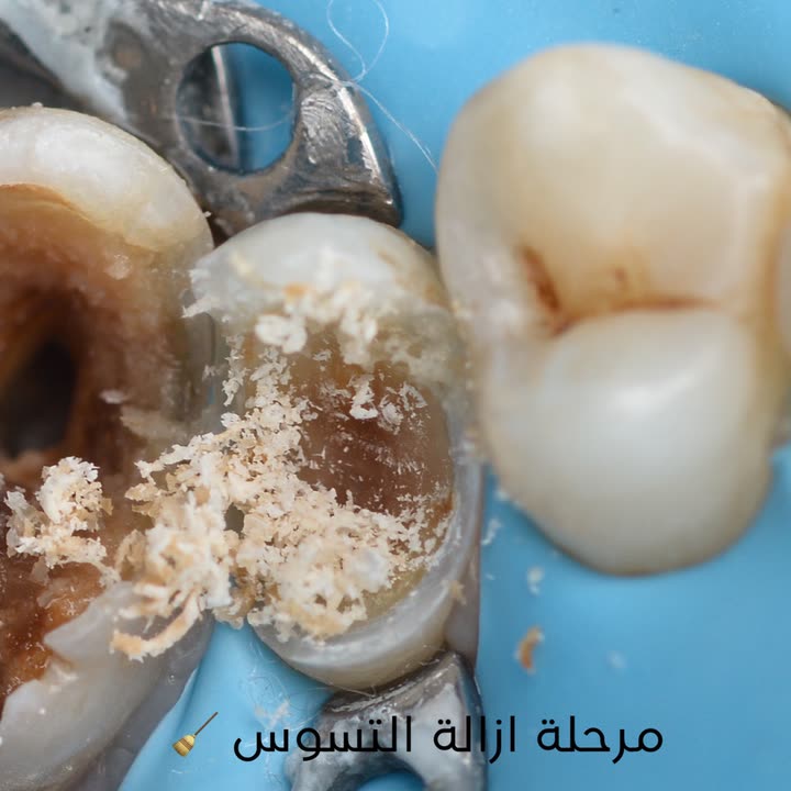 محتوى سناب شات لـ Dr Munther ✨🦷