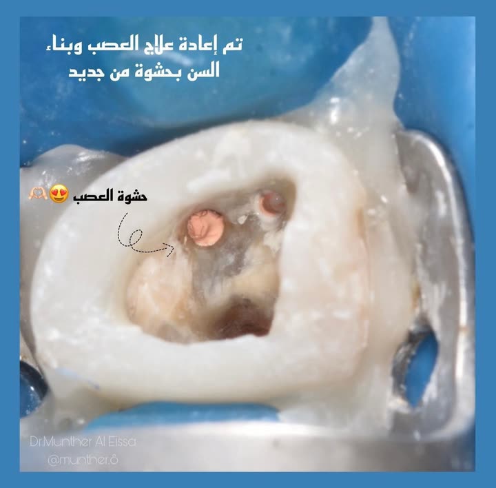 محتوى سناب شات لـ Dr Munther ✨🦷