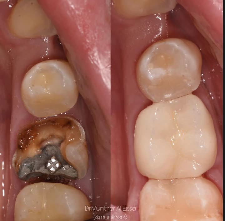 محتوى سناب شات لـ Dr Munther ✨🦷