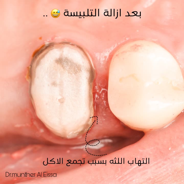 محتوى سناب شات لـ Dr Munther ✨🦷