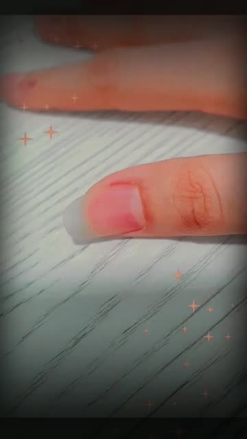 Preview for a Spotlight video that uses the SPRINKLES Lens