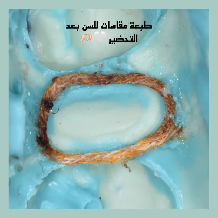 محتوى سناب شات لـ Dr Munther ✨🦷
