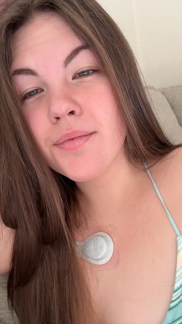 Iv Glutathione Before And After Videos