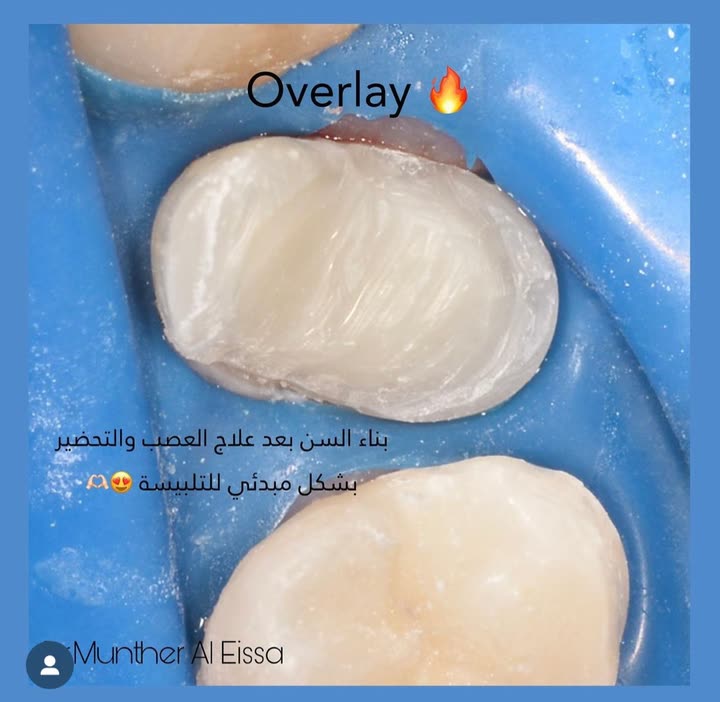 محتوى سناب شات لـ Dr Munther ✨🦷
