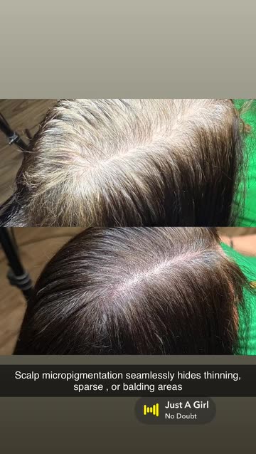 how many days glutathione tablet take to work Glutathione vs Kojic Acid - Which is Better for Skin?