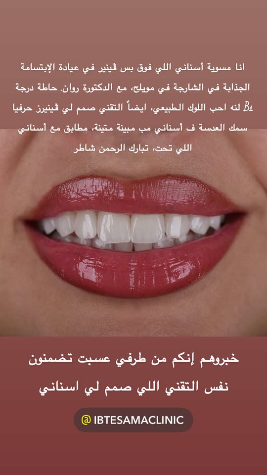 توما النعيمي Spotlight #fapchati7