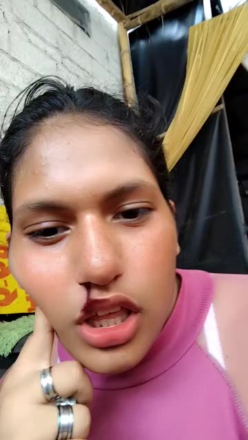 Preview for a Spotlight video that uses the hurt Lens