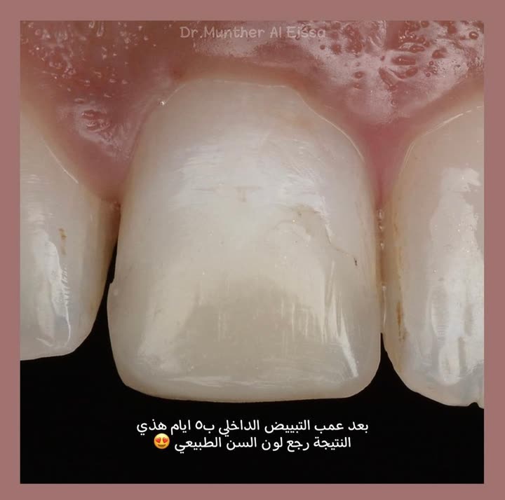 محتوى سناب شات لـ Dr Munther ✨🦷