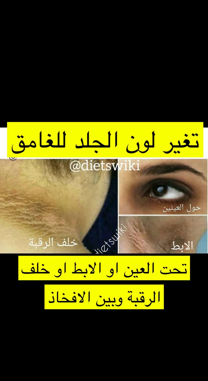 محتوى سناب شات لـ عمار العمار “DietsWiki"