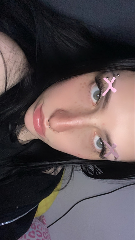 spitvomitt