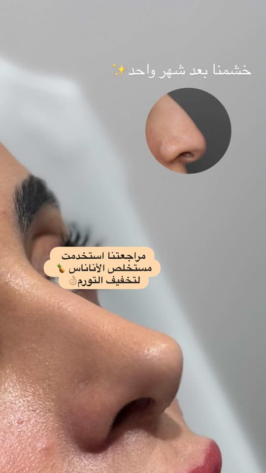 د. محمد الصامل Spotlight #fapchati7
