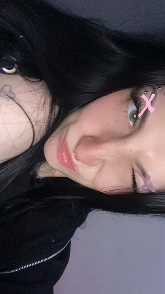 spitvomitt