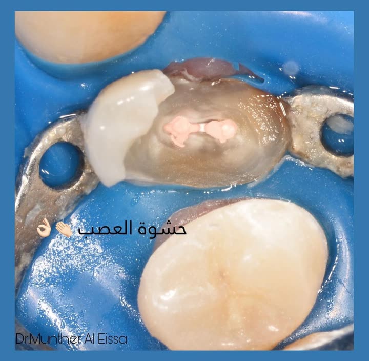 محتوى سناب شات لـ Dr Munther ✨🦷