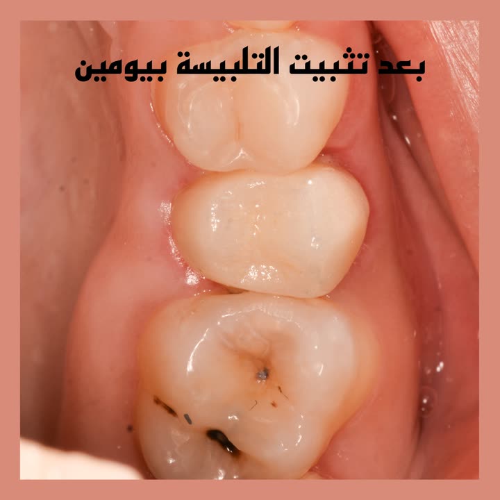 محتوى سناب شات لـ Dr Munther ✨🦷