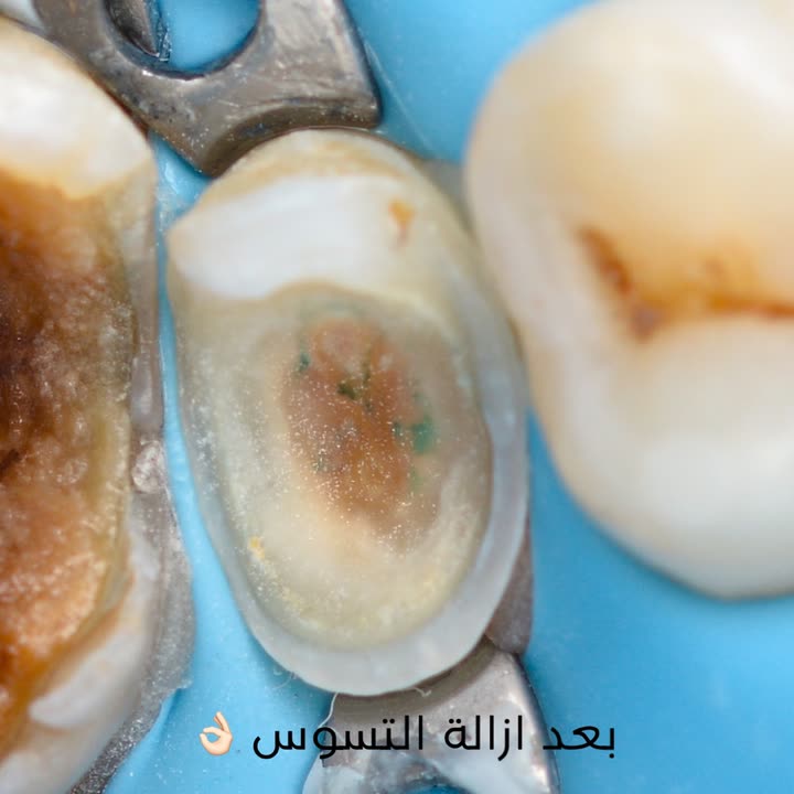 محتوى سناب شات لـ Dr Munther ✨🦷