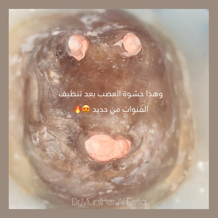 محتوى سناب شات لـ Dr Munther ✨🦷
