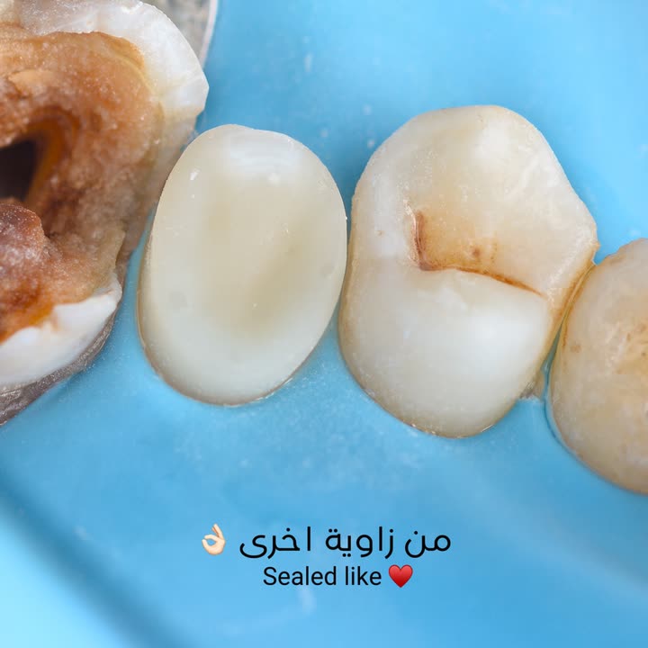 محتوى سناب شات لـ Dr Munther ✨🦷