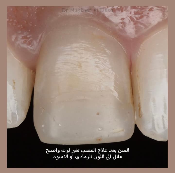 محتوى سناب شات لـ Dr Munther ✨🦷