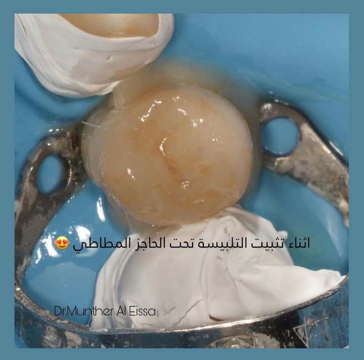 محتوى سناب شات لـ Dr Munther ✨🦷