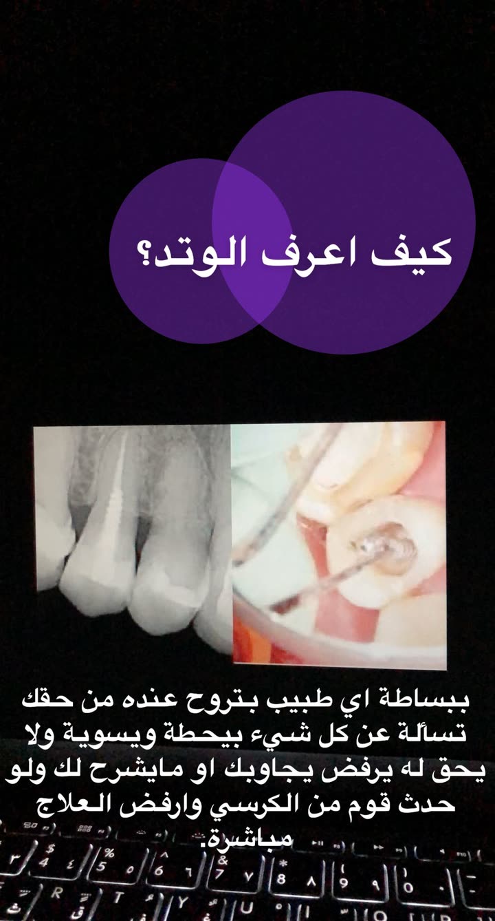 محتوى سناب شات لـ د. ساره الفدا