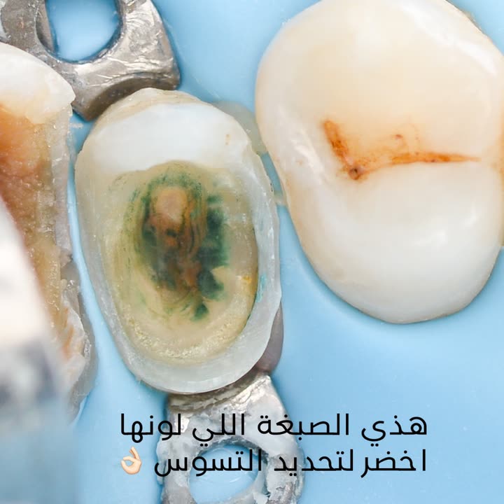 محتوى سناب شات لـ Dr Munther ✨🦷