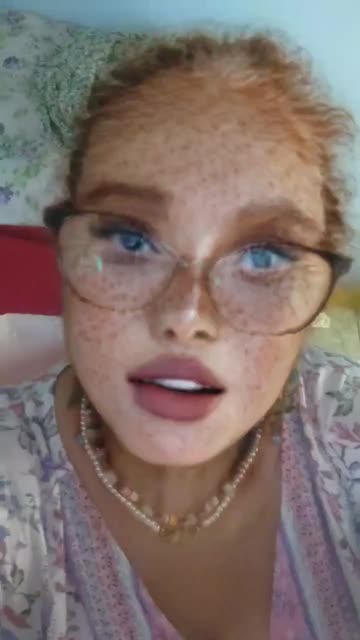 Preview for a Spotlight video that uses the  Freckle Charm Lens
