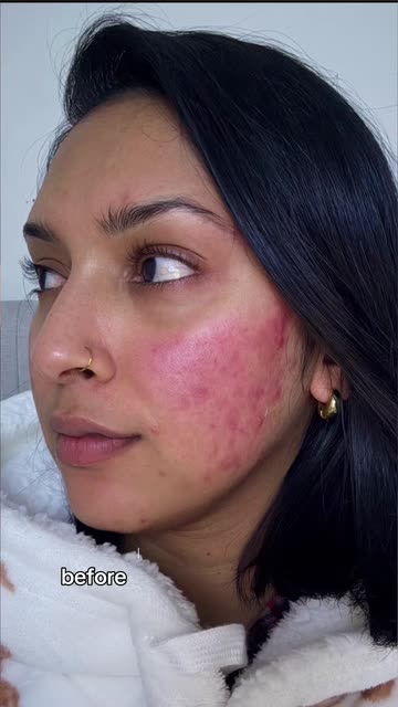 is l glutathione good for skin whitening is liposomal glutathione effective for skin whitening Liposomal Glutathione  for Anti-Aging