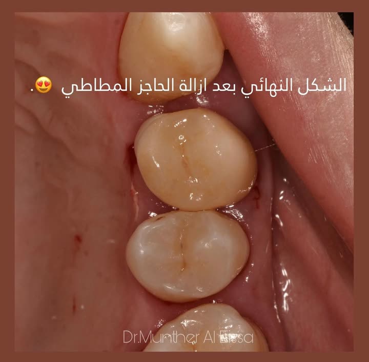 محتوى سناب شات لـ Dr Munther ✨🦷