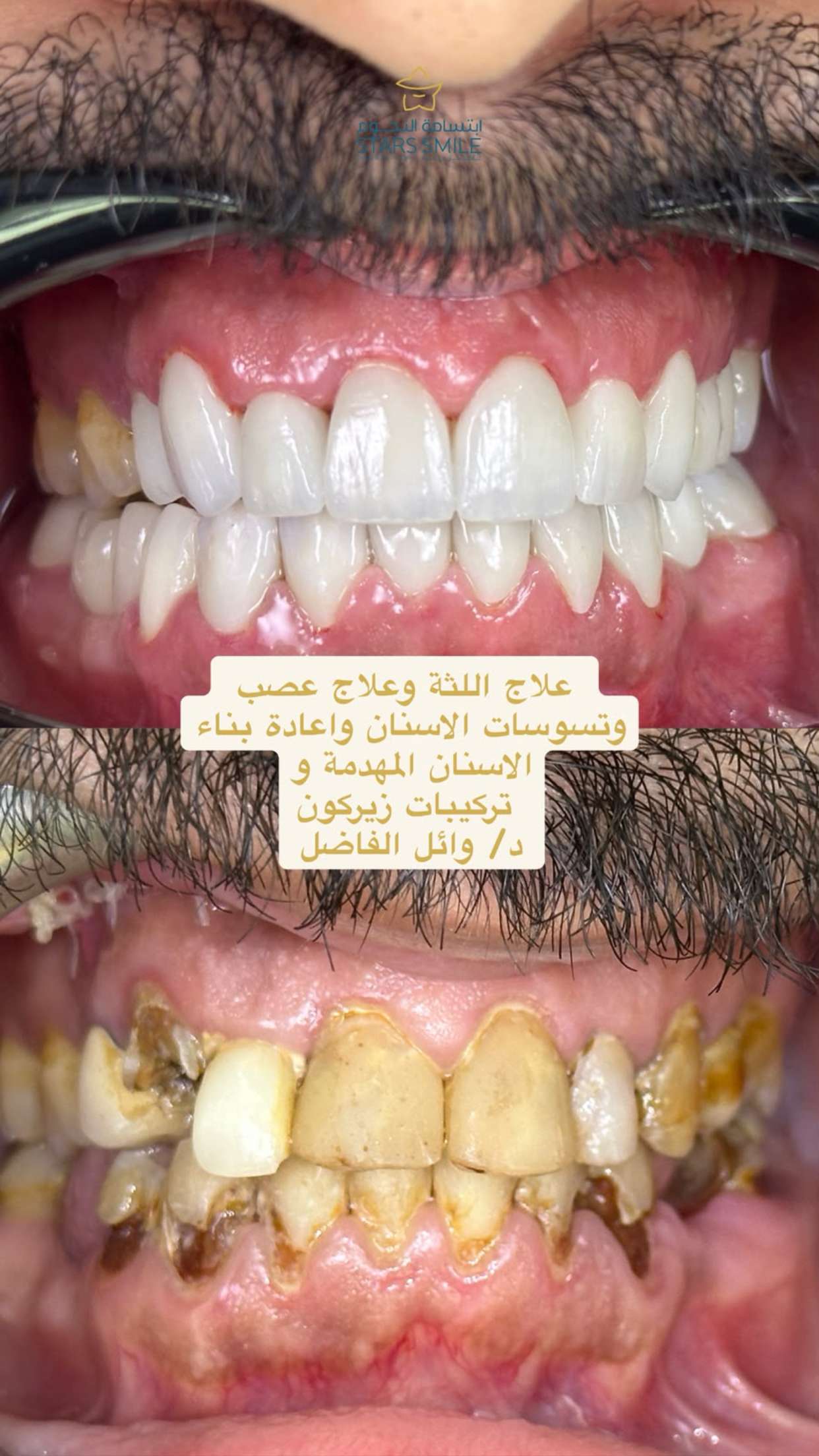 محتوى سناب شات لـ احمد الجار || Aljar