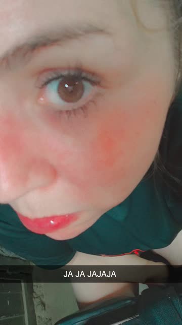 Preview for a Spotlight video that uses the Watermelon Lens