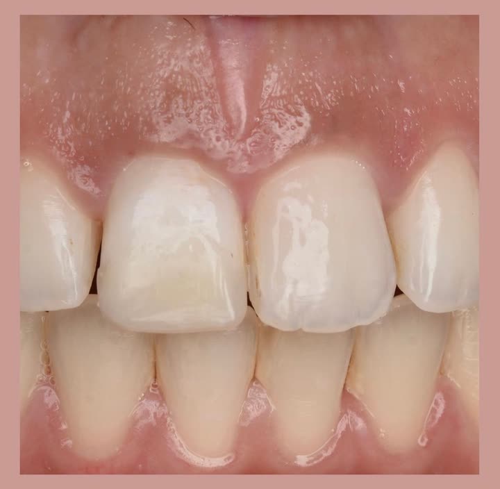 محتوى سناب شات لـ Dr Munther ✨🦷