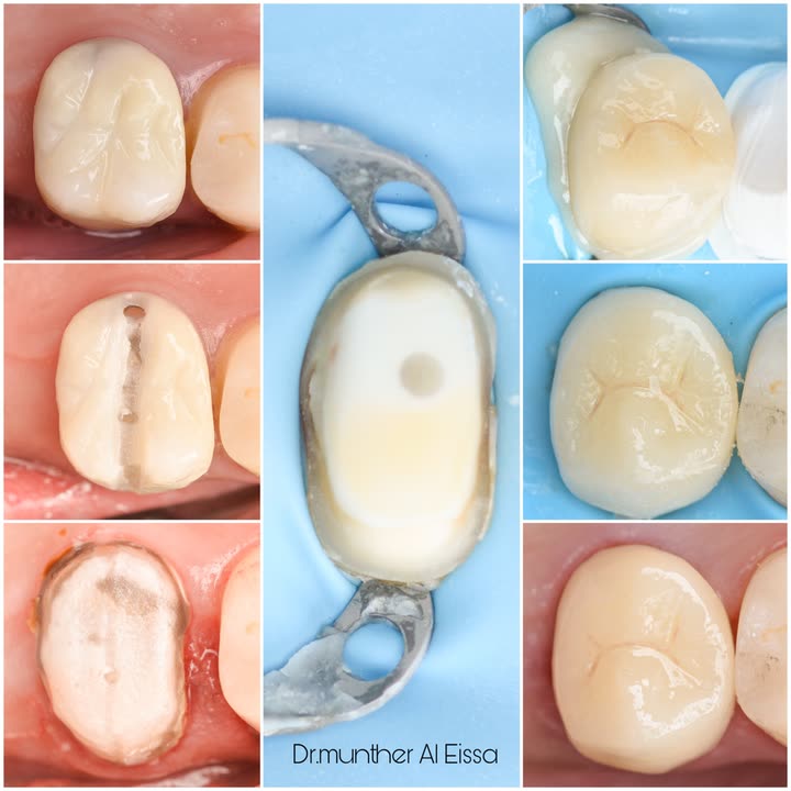 محتوى سناب شات لـ Dr Munther ✨🦷