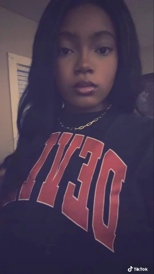 bracefacerae