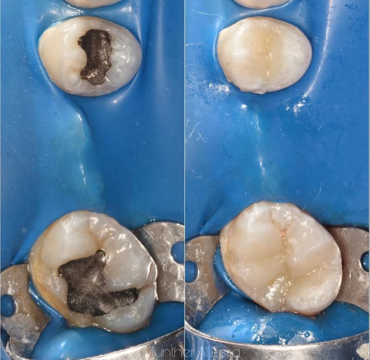 محتوى سناب شات لـ Dr Munther ✨🦷