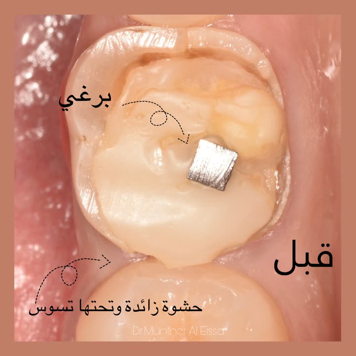 محتوى سناب شات لـ Dr Munther ✨🦷