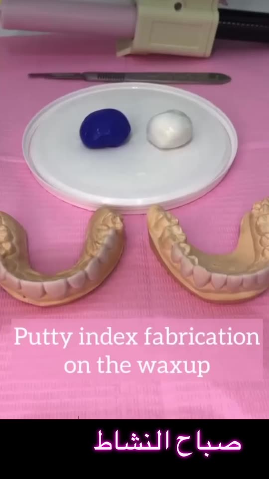 Putty index fabrication 
