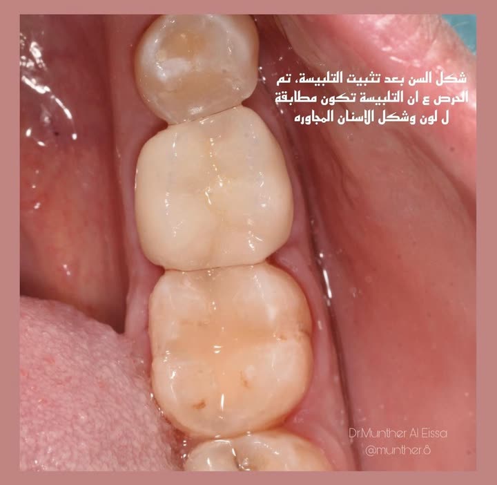 محتوى سناب شات لـ Dr Munther ✨🦷