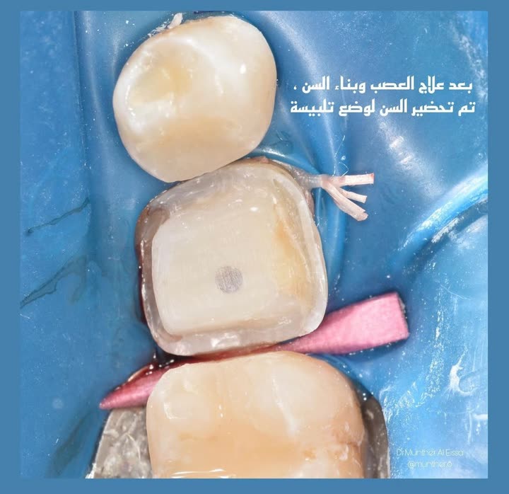 محتوى سناب شات لـ Dr Munther ✨🦷